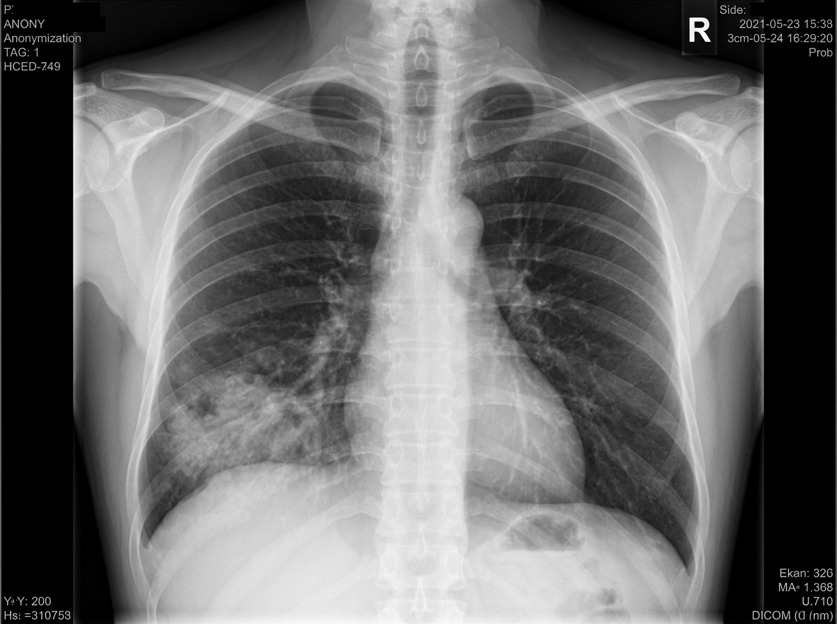 Diagnosis thumbnail